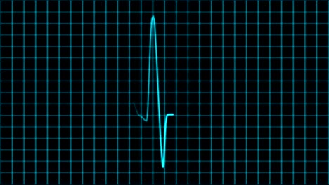 Kardiogramm-Kardiograph-Oszilloskop-Bildschirmschleife-4k